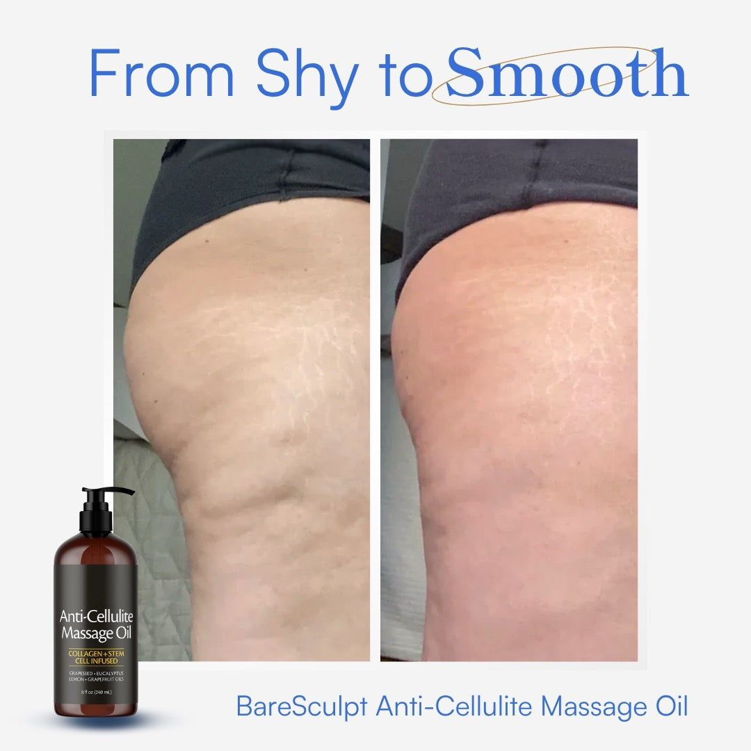 Anti-Cellulite Massage Oil - 8oz (240ml)
